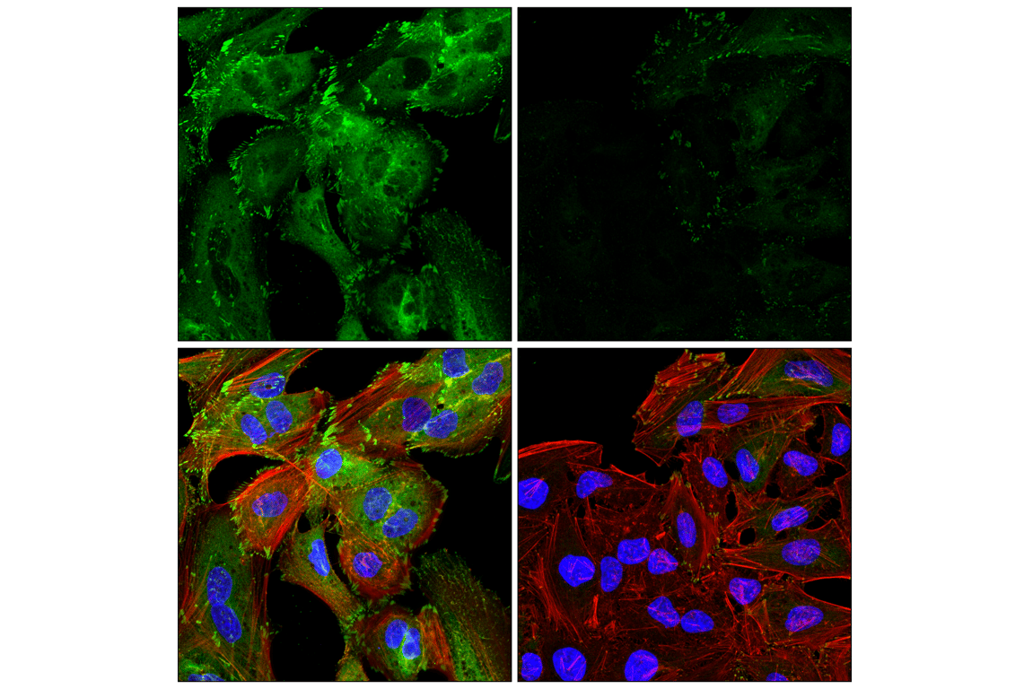 Immunofluorescence Image 2: VASP (F3S3F) Rabbit Monoclonal Antibody