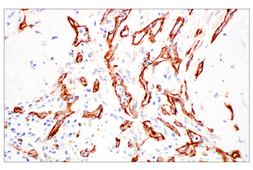 Immunohistochemistry Image 2: Nestin (E4O9E) XP<sup>®</sup> Rabbit mAb