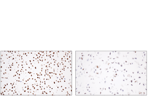 Immunohistochemistry Image 3: PRAME (E7I1B) Rabbit Monoclonal Antibody