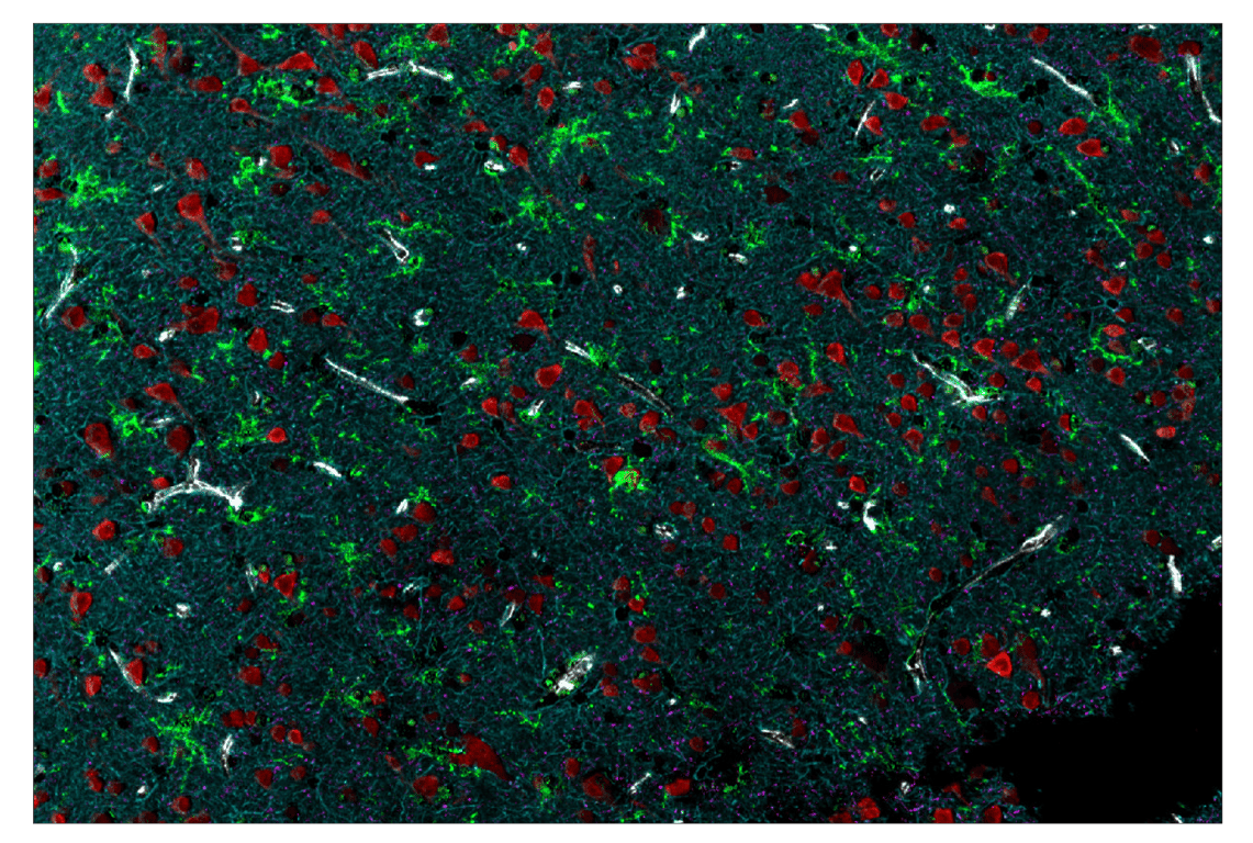 Immunohistochemistry Image 2: GFAP (E4L7M) & CO-0097-647 SignalStar<sup>™</sup> Oligo-Antibody Pair