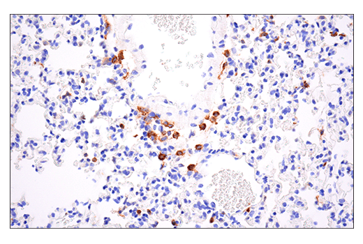 Immunohistochemistry Image 2: CD86 (E5W6H) Rabbit Monoclonal Antibody (BSA and Azide Free)