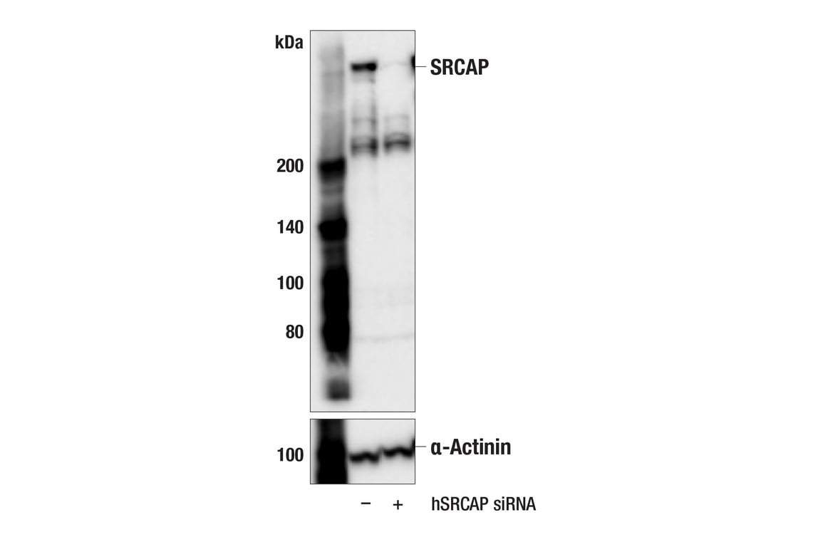 Western Blotting Image 2: SRCAP (E9V8O) Rabbit Monoclonal Antibody