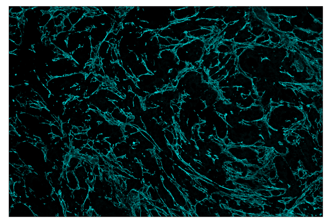 Immunohistochemistry Image 5: COL1A1 (E8F4L) & CO-0106-488 SignalStar<sup>™</sup> Oligo-Antibody Pair