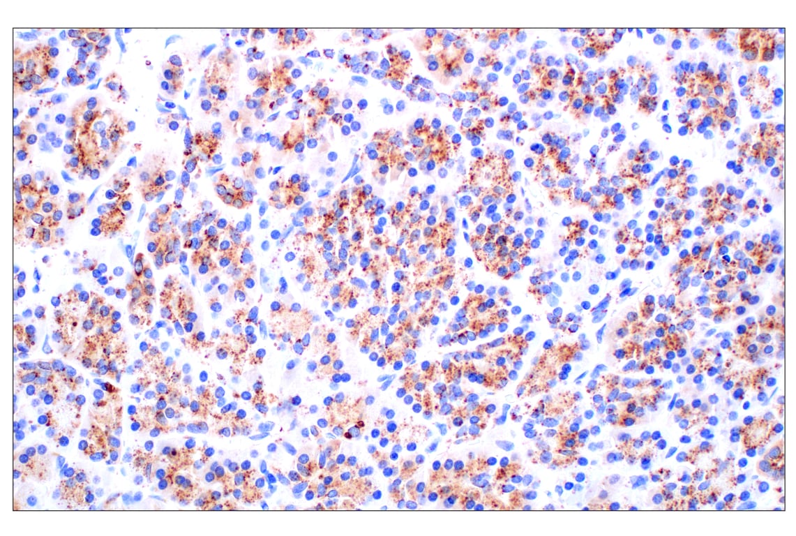 undefined Image 32: Genetics of Parkinson's Disease: Lysosomal Dysfunction Antibody Sampler Kit
