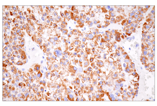 Immunohistochemistry Image 1: CPS1/Hep Par-1 (E9I9U) Rabbit Monoclonal Antibody