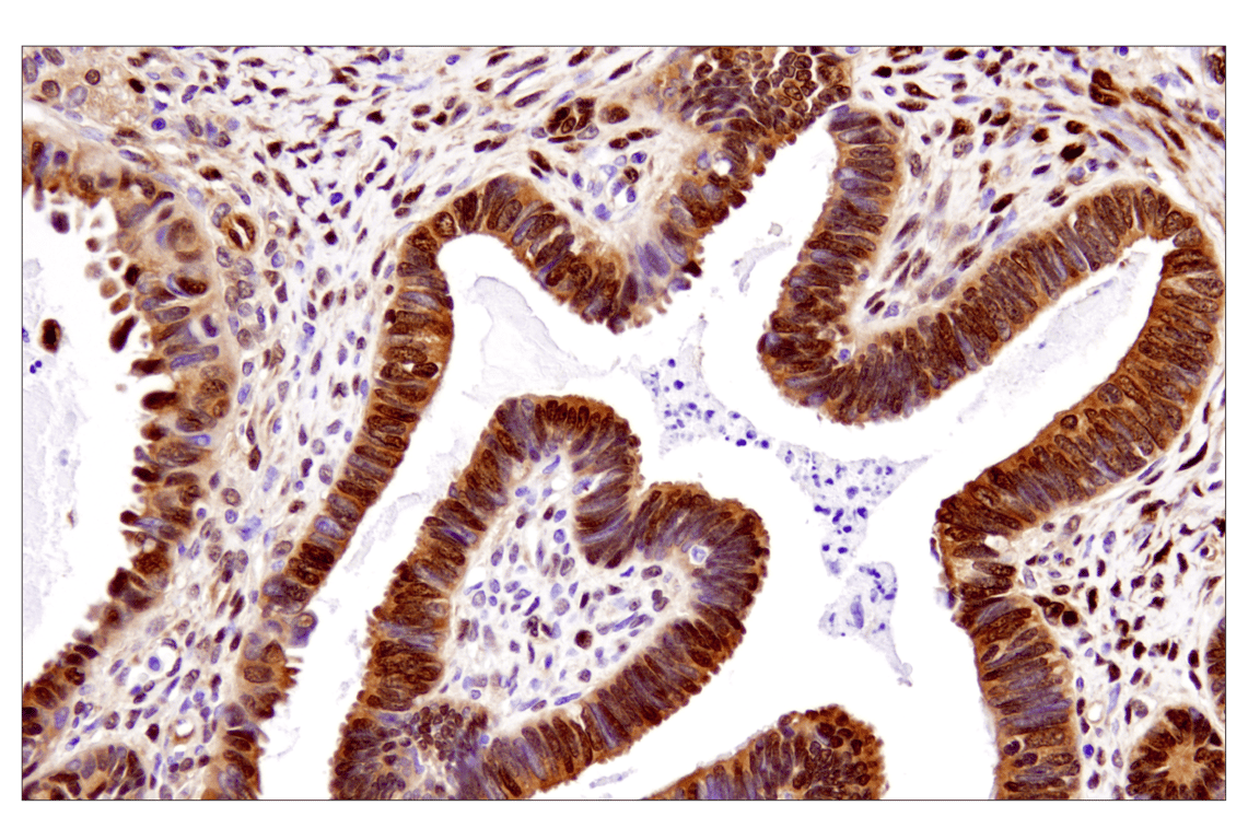 Immunohistochemistry Image 3: YAP (D8H1X) Rabbit Monoclonal Antibody