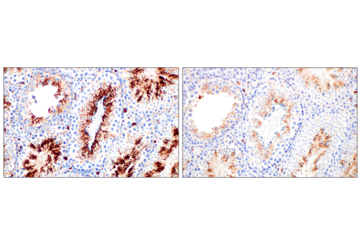 Immunohistochemistry Image 8: CD206/MRC1 (E6T5J) Rabbit Monoclonal Antibody