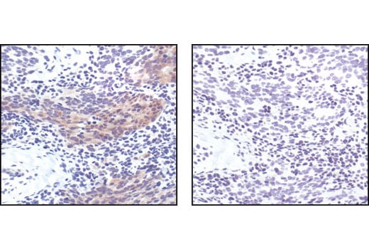 Immunohistochemistry Image 2: Phospho-Bad (Ser112) (40A9) Rabbit Monoclonal Antibody (BSA and Azide Free)