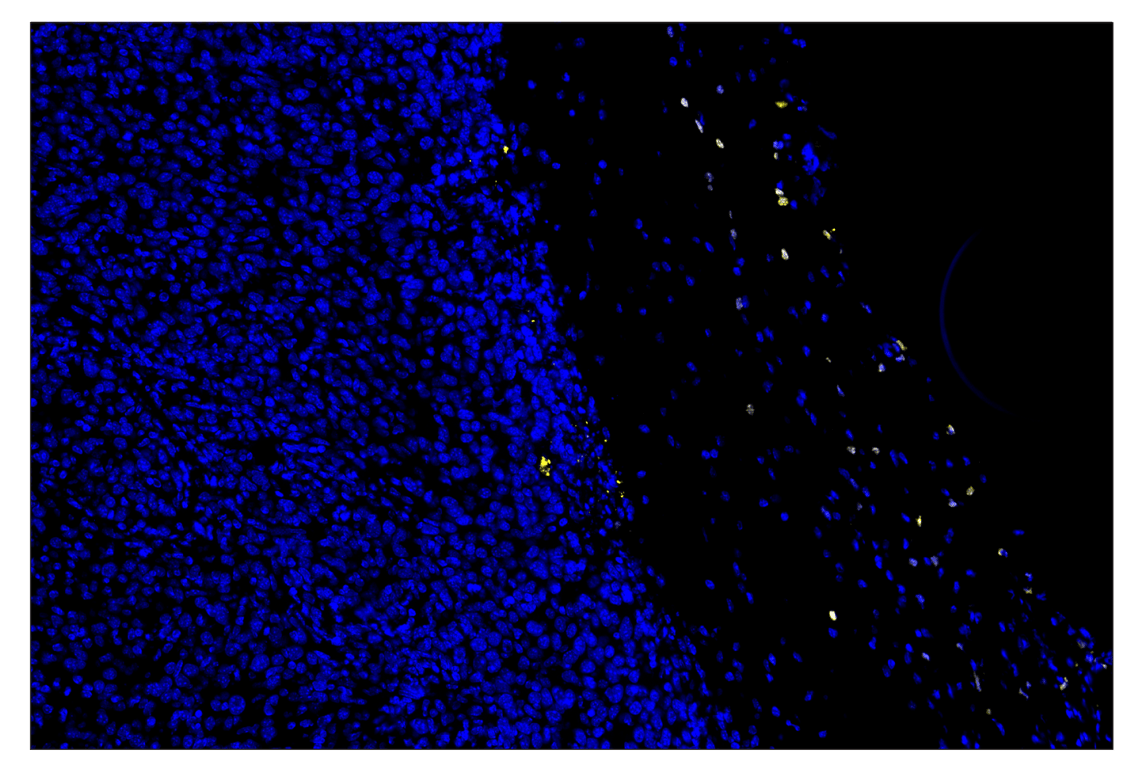 Immunohistochemistry Image 1: Citrullinated Histone H3 (Arg17) (E4O3F) & CO-0201-647 SignalStar<sup>®</sup> Oligo-Antibody Pair