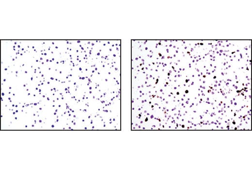 Immunohistochemistry Image 1: Cleaved Lamin A (Small Subunit) Antibody