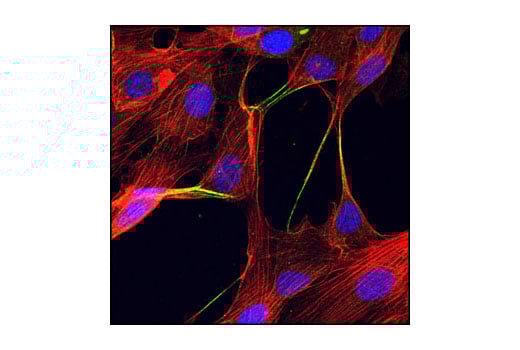 Immunofluorescence Image 1: alpha-Actinin Antibody