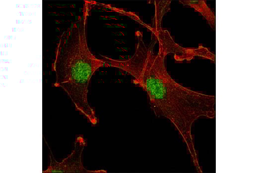 Immunofluorescence Image 1: Ubc9 (D26F2) Rabbit Monoclonal Antibody