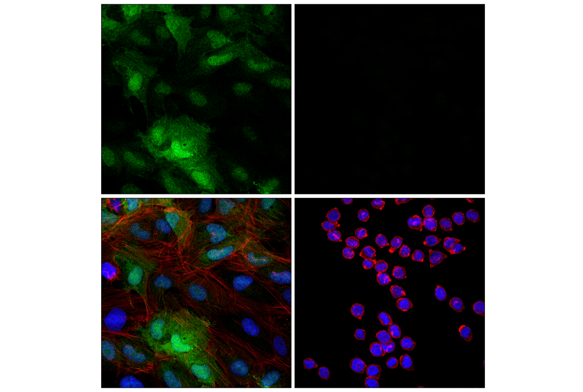 Immunofluorescence Image 1: Transgelin/TAGLN (F3B7H) Rabbit Monoclonal Antibody