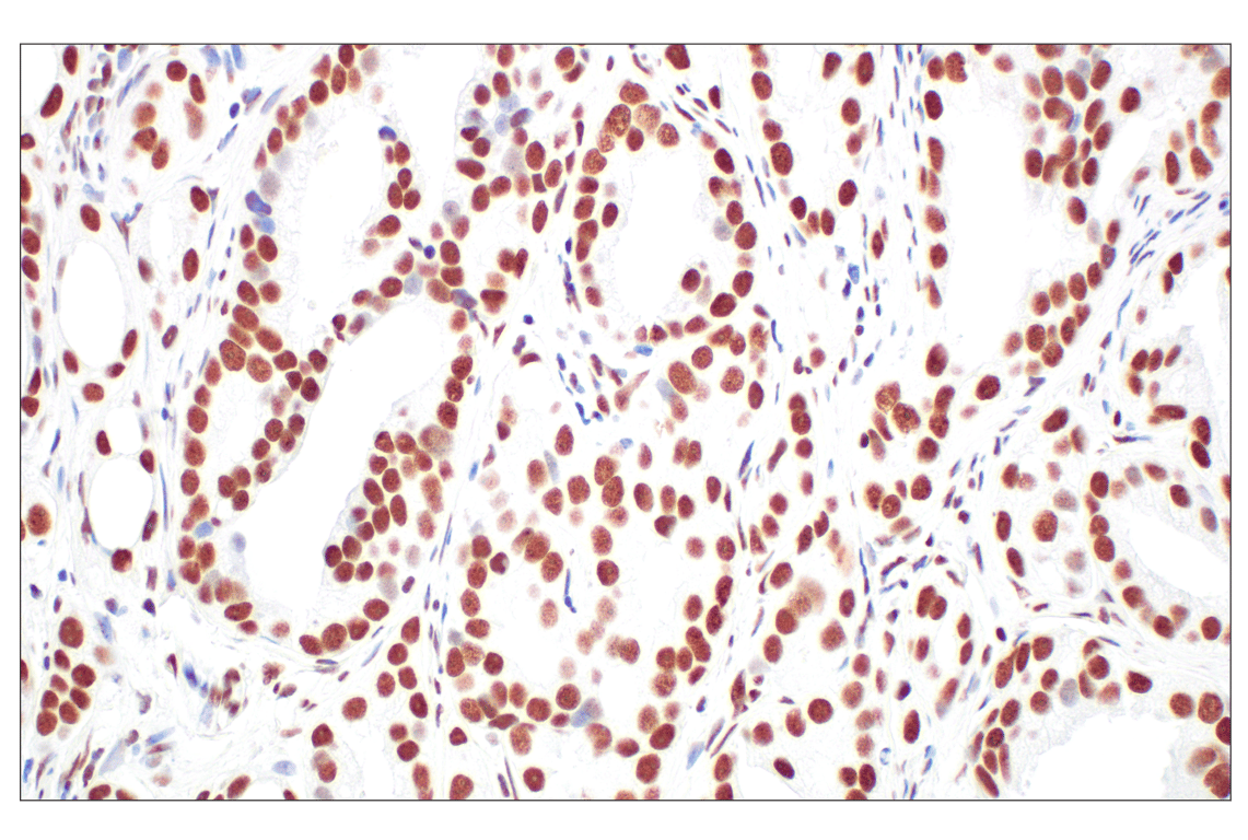 Immunohistochemistry Image 1: CBX7 (E7N1W) Rabbit Monoclonal Antibody