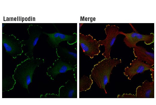 Immunofluorescence Image 1: Lamellipodin (D8A2K) Rabbit Monoclonal Antibody