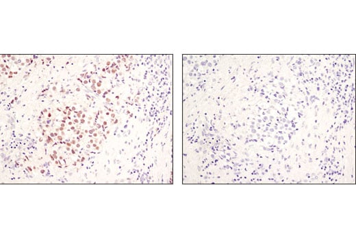 Immunohistochemistry Image 1: Mouse (G3A1) Monoclonal Antibody IgG1 Isotype Control