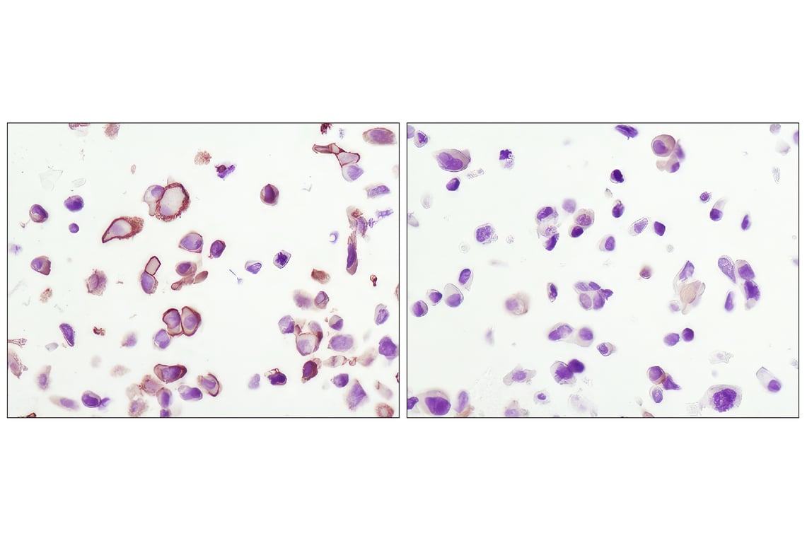 Immunohistochemistry Image 7: Phospho-Akt (Ser473) (D9E) XP<sup>®</sup> Rabbit mAb (BSA and Azide Free)