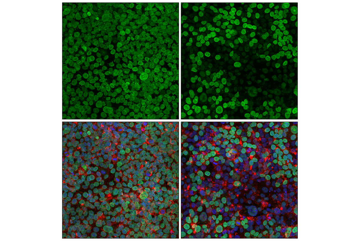 Immunofluorescence Image 1: Exportin-1/CRM1 (D6V7N) Rabbit Monoclonal Antibody