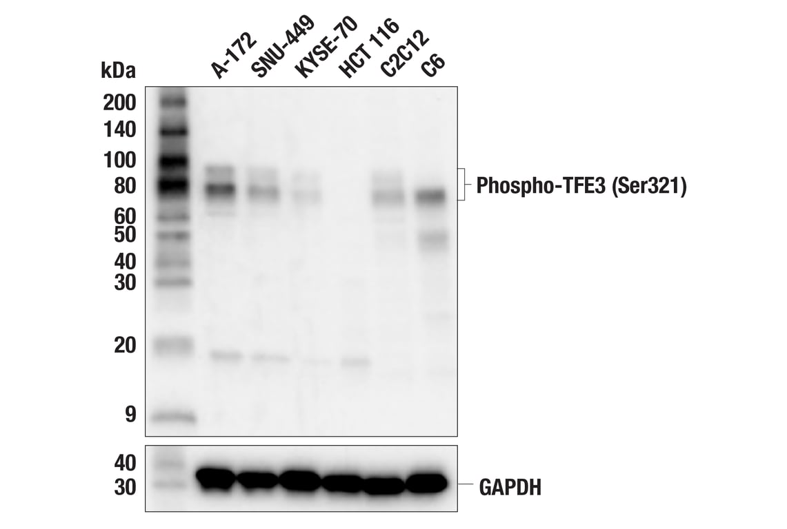 Western Blotting Image 2: Phospho-TFE3 (Ser321) (F1E8R) Rabbit Monoclonal Antibody