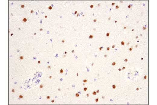 CHD5 (D2F9Q) Rabbit mAb | Cell Signaling Technology