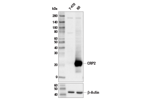 Western Blotting Image 1: CRP2 (E8R5N) Rabbit mAb