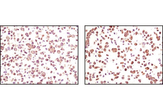 Immunohistochemistry Image 2: Akt (pan) (40D4) Mouse mAb