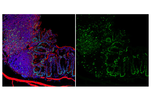 Immunofluorescence Image 3: Tox/Tox2 (E6G5O) Rabbit mAb