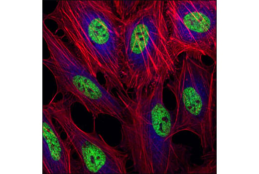 Immunofluorescence Image 1: Mono-Methyl-Histone H3 (Lys4) (D1A9) Rabbit Monoclonal Antibody