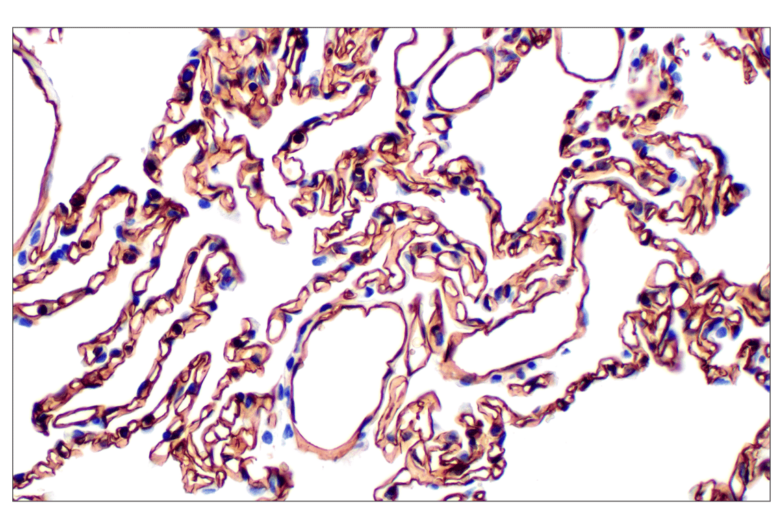 Immunohistochemistry Image 2: CD31 (PECAM-1) (F8M3S) Rabbit Monoclonal Antibody (BSA and Azide Free)