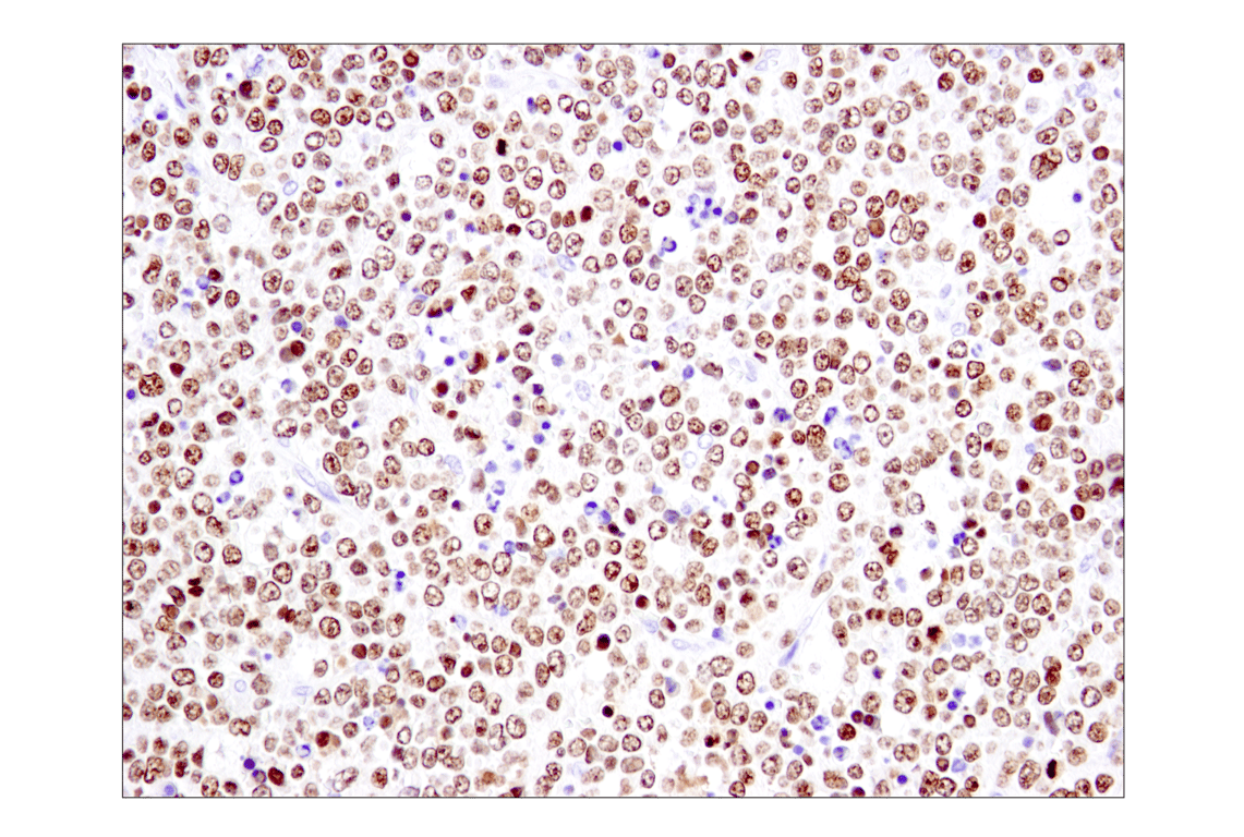 Immunohistochemistry Image 2: Ikaros (D6N9Y) Rabbit Monoclonal Antibody