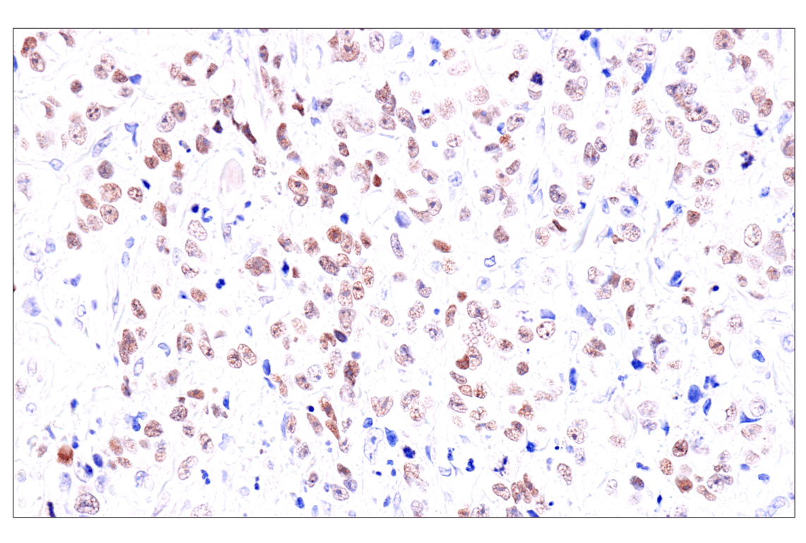 Immunohistochemistry Image 7: GATA-6 (D61E4) Rabbit Monoclonal Antibody