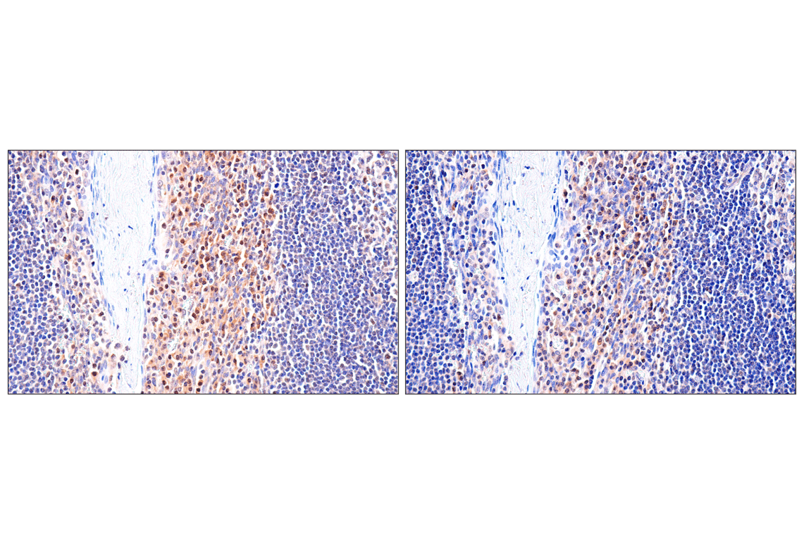 Immunohistochemistry Image 11: ADAR1 p150 Isoform (E6U1U) Rabbit Monoclonal Antibody