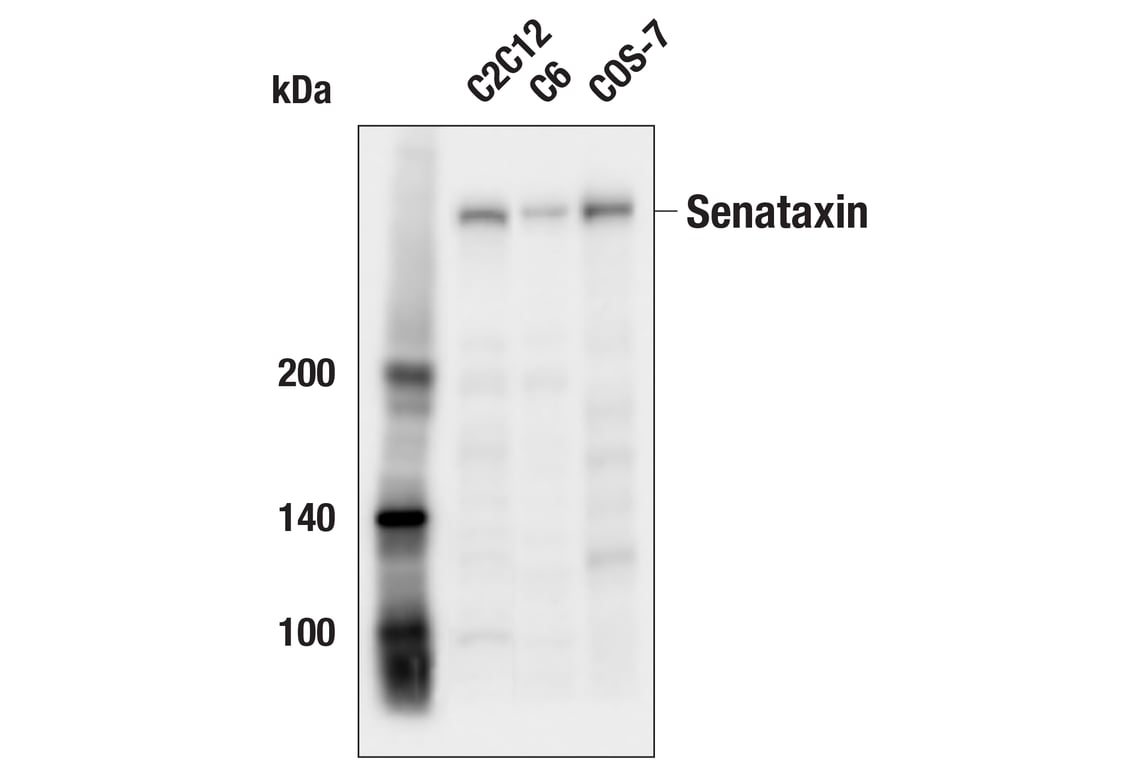 Western Blotting Image 2: Senataxin (E9Z9F) Rabbit Monoclonal Antibody