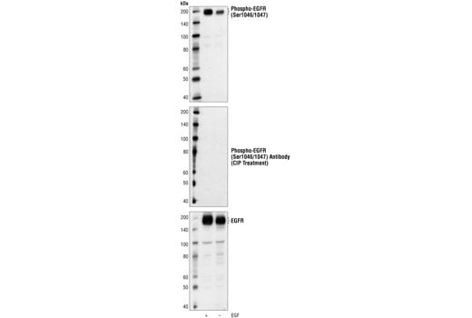 Western Blotting Image 1: Phospho-EGF Receptor (Ser1046/1047) Antibody