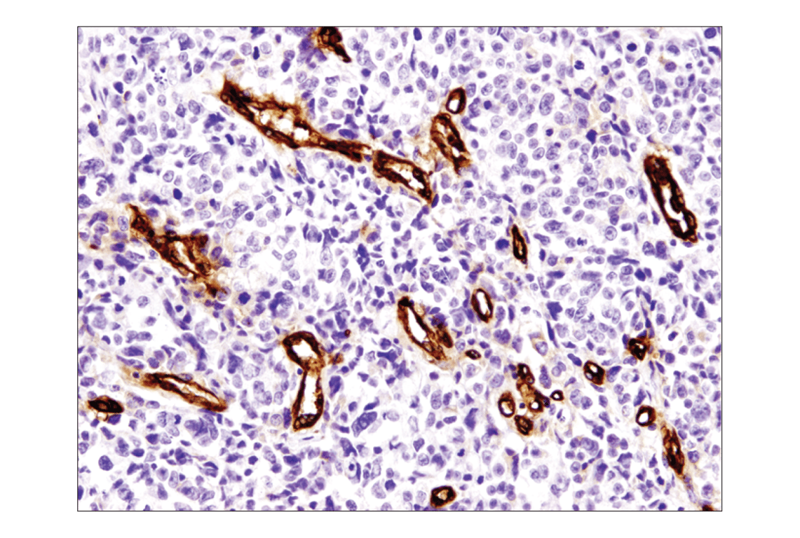 Immunohistochemistry Image 1: CD36 (D8L9T) Rabbit Monoclonal Antibody (BSA and Azide Free)