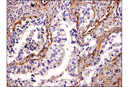 Immunohistochemistry Image 2: Vinculin (E1E9V) XP<sup>®</sup> Rabbit mAb (BSA and Azide Free)