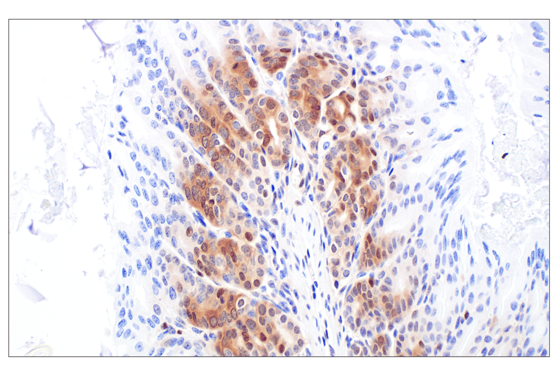 Immunohistochemistry Image 8: CDK4 (F8L5F) Rabbit Monoclonal Antibody