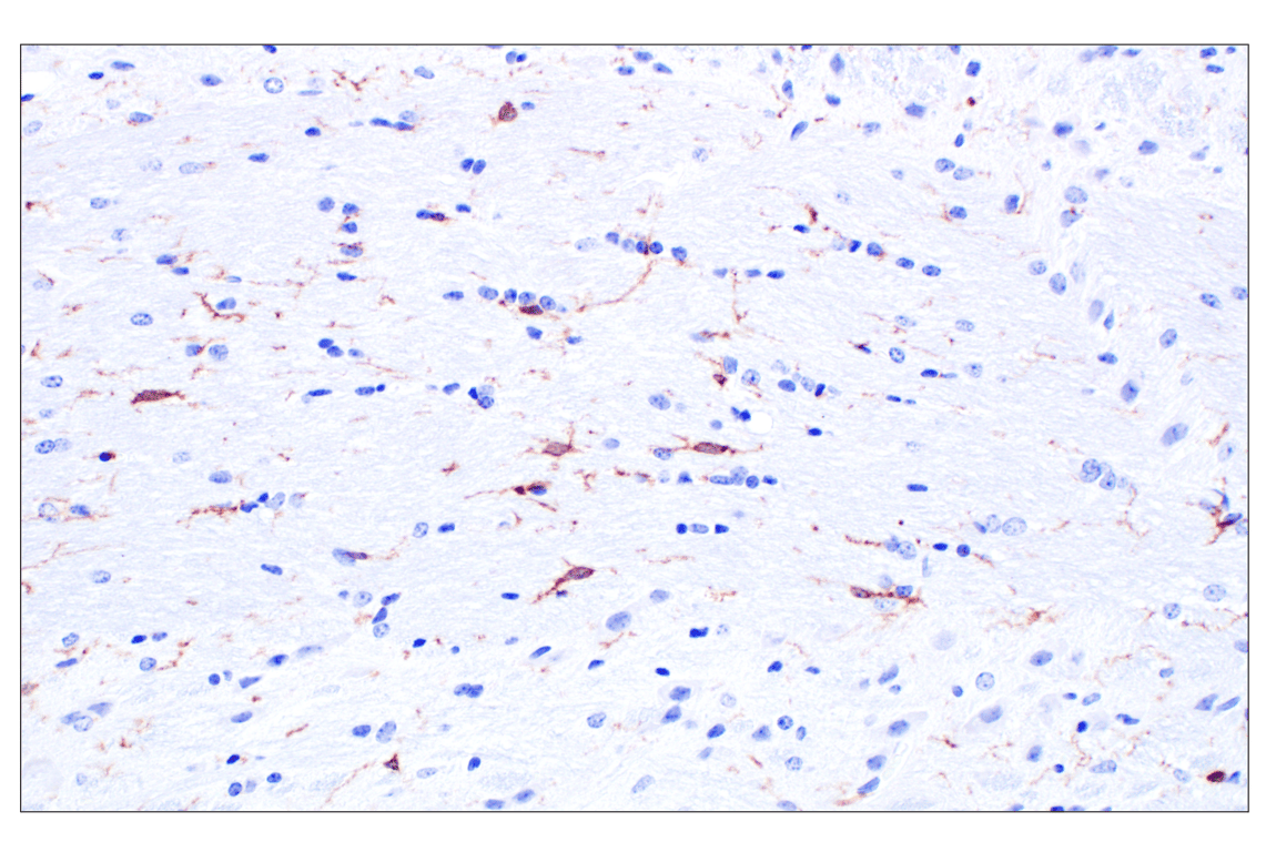 CSF-1R/M-CSF-R (F1H1I) Rabbit Monoclonal Antibody | Cell Signaling