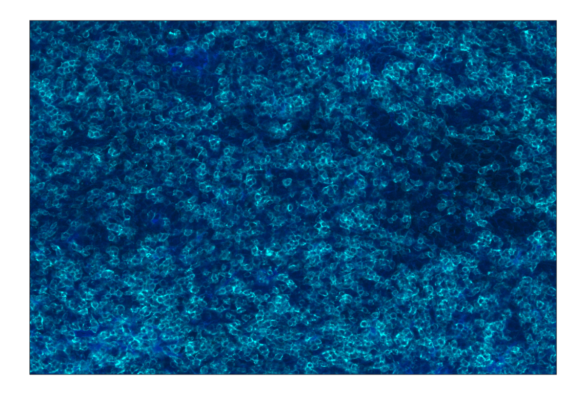 Immunohistochemistry Image 2: CD8 alpha (D8A8Y) Rabbit Monoclonal Antibody (Alexa Fluor<sup>®</sup> 750 Conjugate)