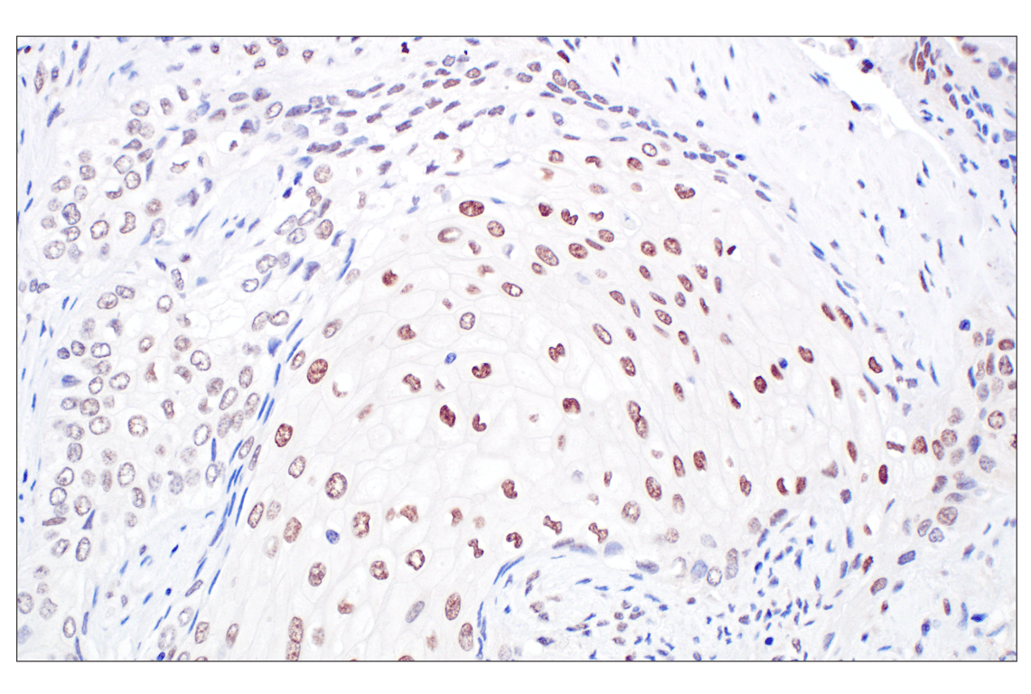 Immunohistochemistry Image 2: TFE3 (F3Z2Q) Rabbit Monoclonal Antibody