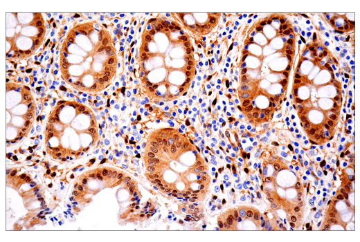 Immunohistochemistry Image 3: YAP/TAZ (E9M8G) Rabbit Monoclonal Antibody (BSA and Azide Free)