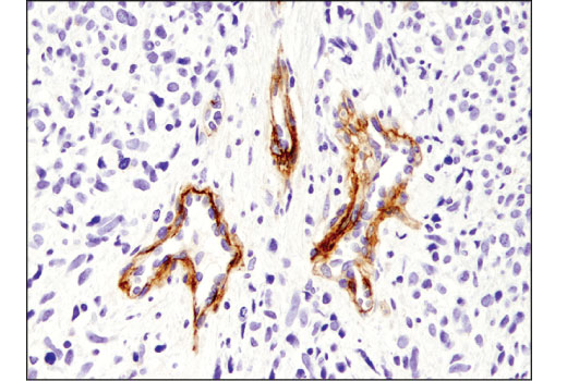 Immunohistochemistry Image 3: HGF beta (D6S7D) Rabbit Monoclonal Antibody