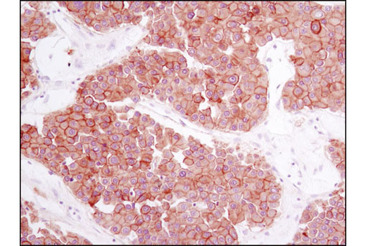 Immunohistochemistry Image 1: Met (D1C2) Rabbit Monoclonal Antibody (BSA and Azide Free)