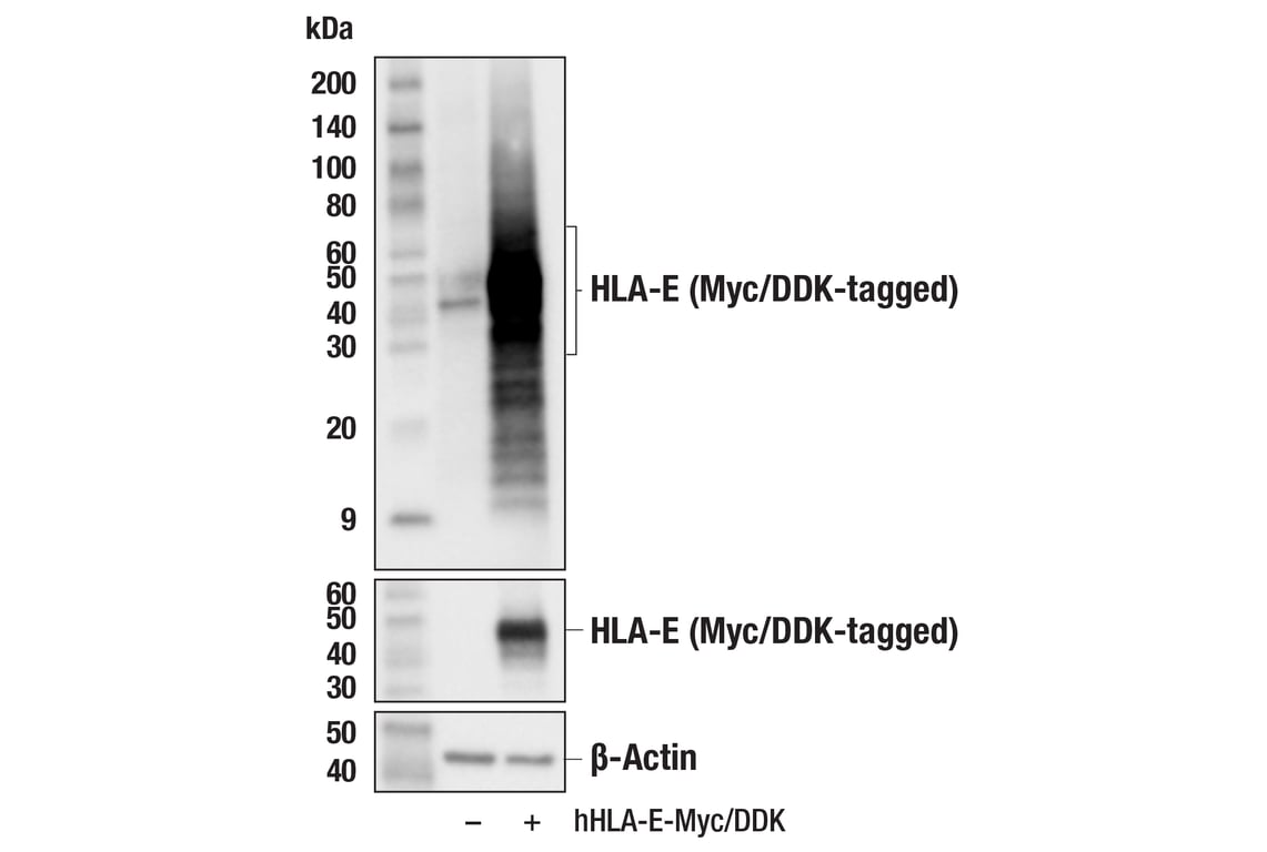 Western Blotting Image 2: HLA-E (MEM-E/02) Mouse Monoclonal Antibody