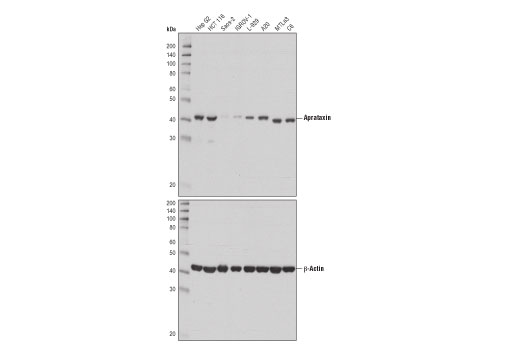 Western Blotting Image 1: Aprataxin (D5P3C) Rabbit mAb