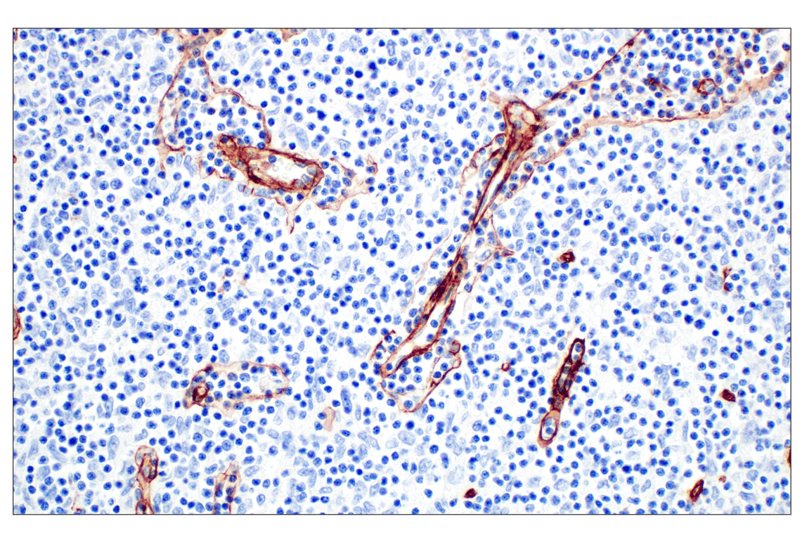 Immunohistochemistry Image 4: COL4A1 (E5M6R) Rabbit Monoclonal Antibody (BSA and Azide Free)