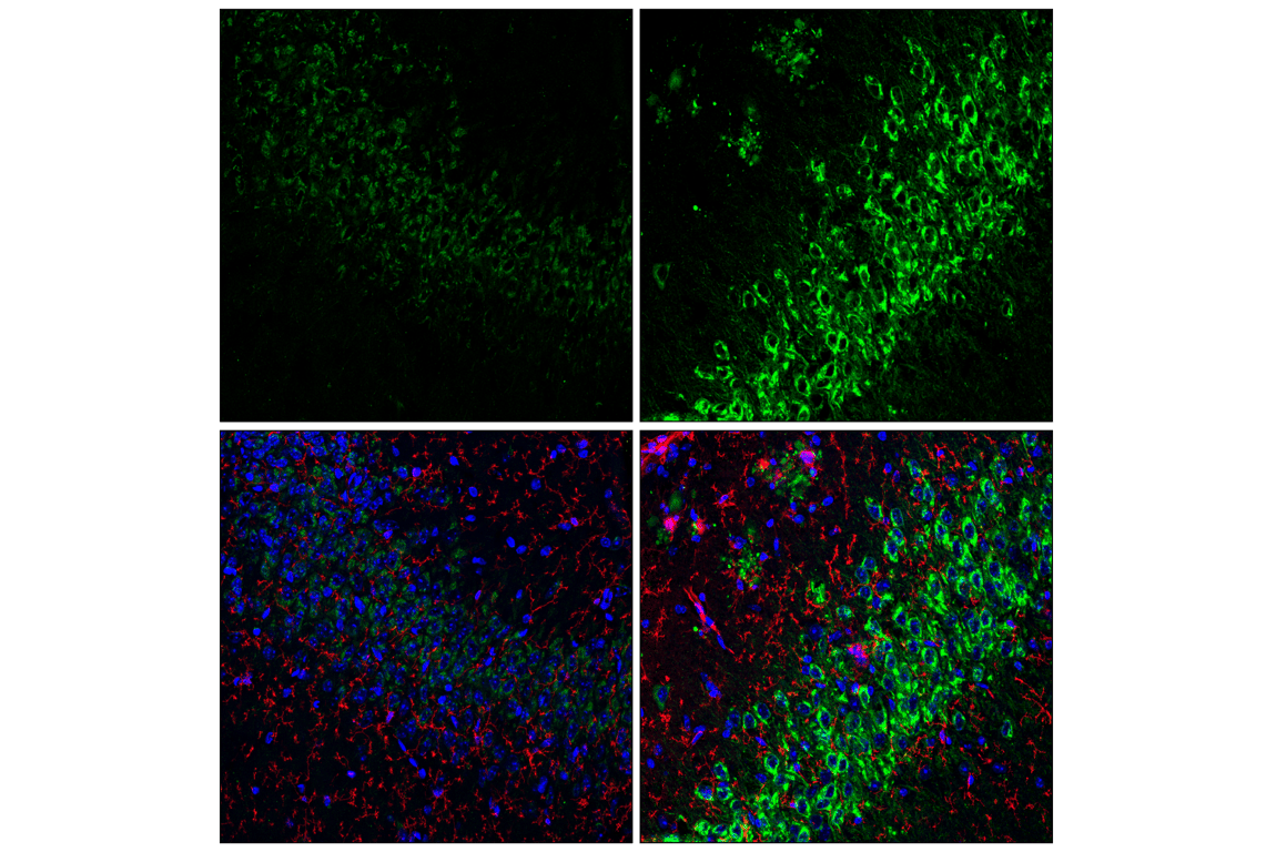 Immunofluorescence Image 1: APP (E3F3P) Rabbit Monoclonal Antibody