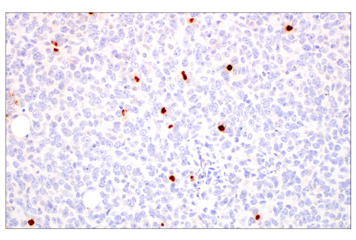 Immunohistochemistry Image 5: Neutrophil Elastase (E8U3X) Rabbit Monoclonal Antibody
