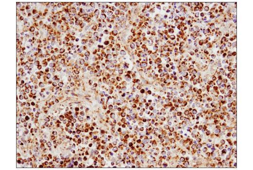 Immunohistochemistry Image 2: SLP-2 (D2I9X) Rabbit Monoclonal Antibody