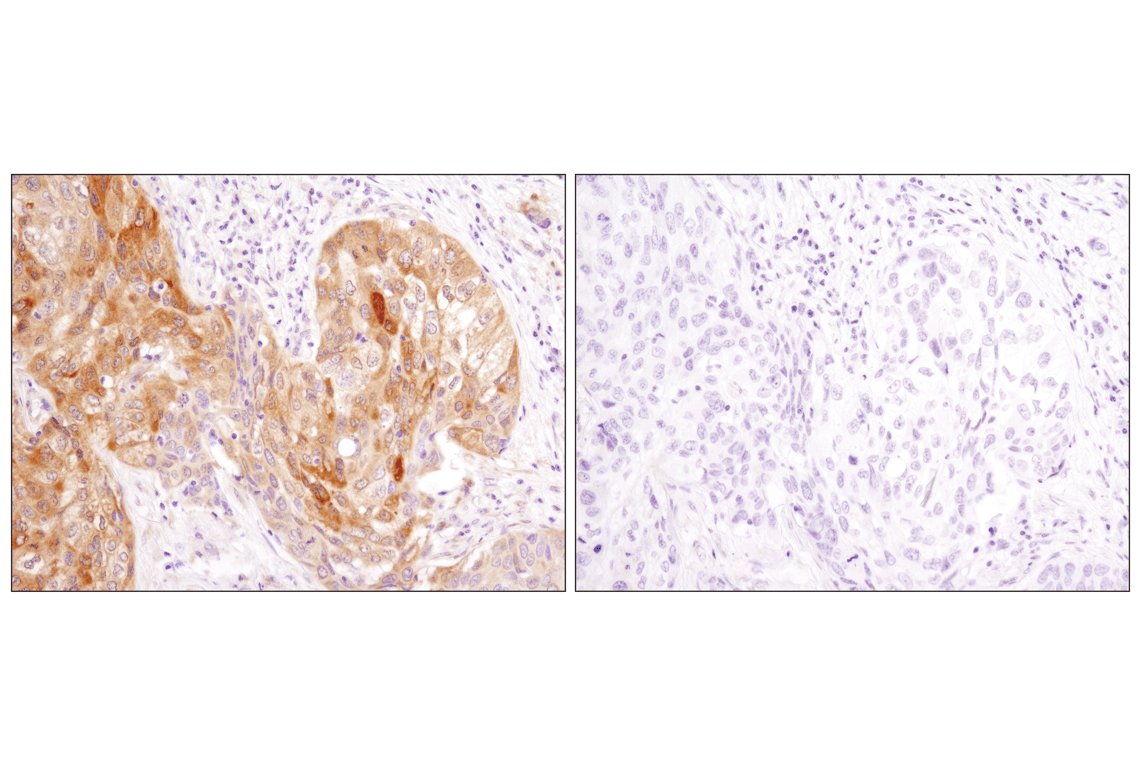 Immunohistochemistry Image 2: LC3A/B (D3U4C) XP<sup>®</sup> Rabbit mAb